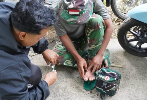 Penanganan Medis Anggota Satgas TMMD Ke-129 Bangli yang Mengalami Luka